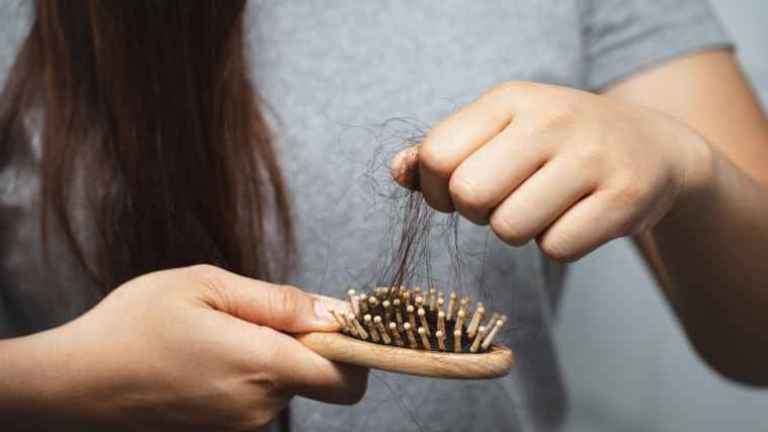 Queda de Cabelo Feminina